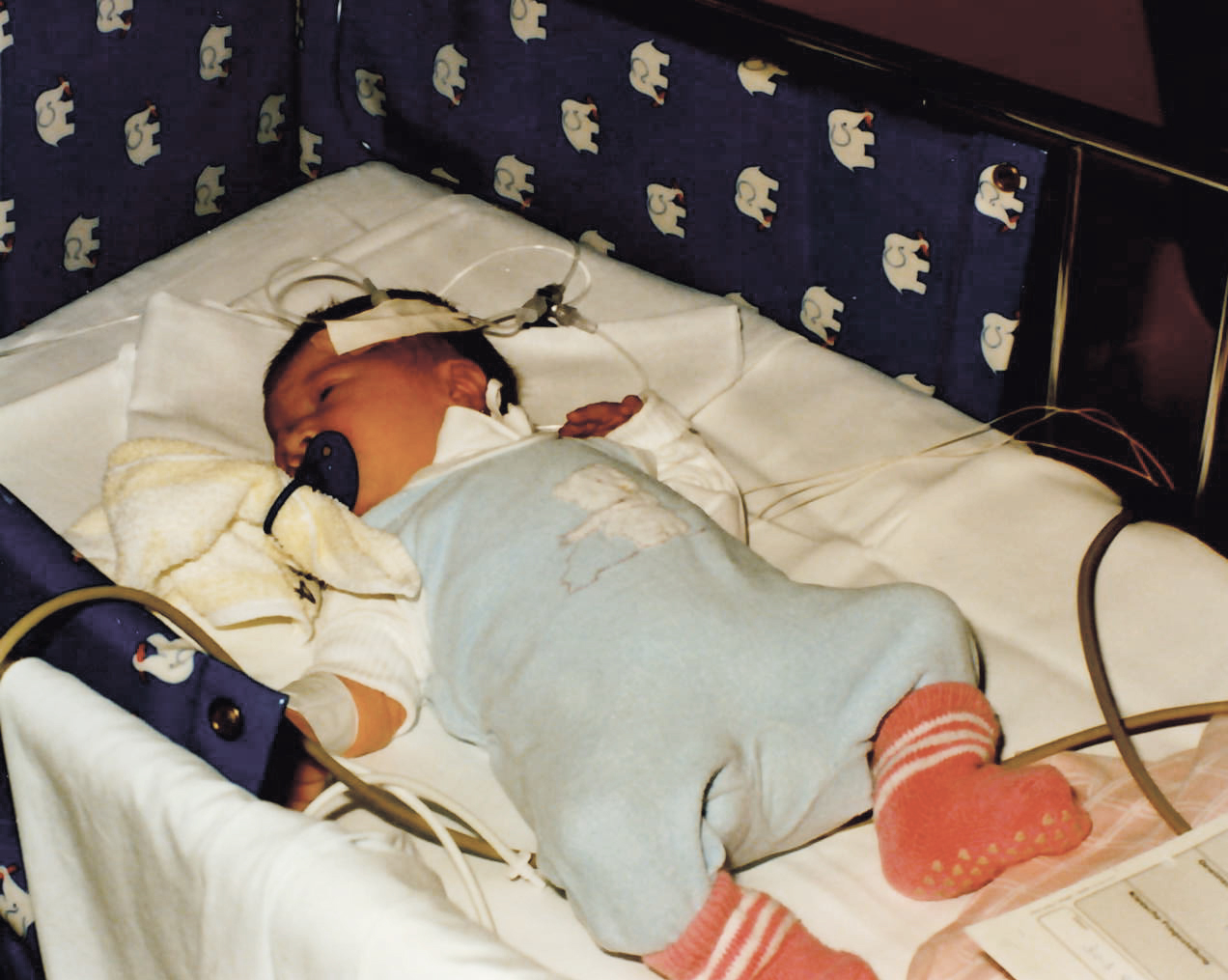 Carola liegt in einem Krankenhausbett, trägt einen blauen Strampler und rote Söckchen, hat einen Schnuller im Mund und ist mit medizinischen Kabeln und Sensoren verbunden.